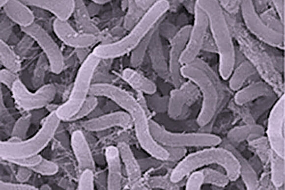 A microscopic image of SAR11, a type of pelagibacterales, which look like worms.